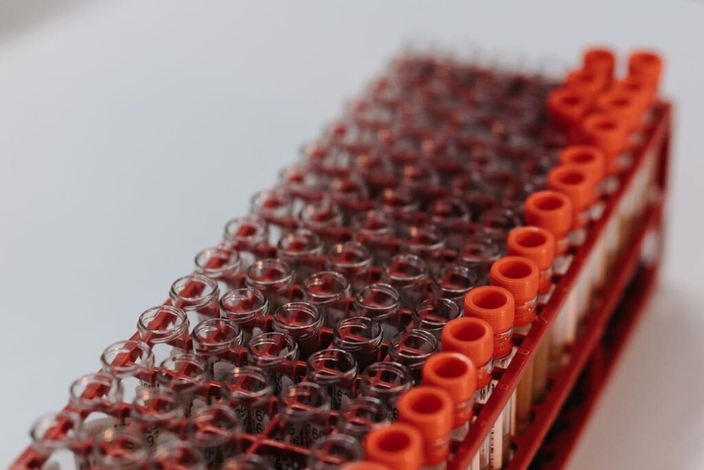 Laboratory test tubes standing in a rack