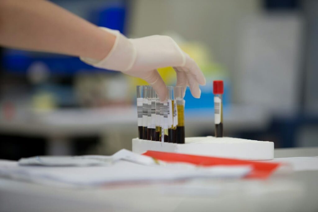 Gloved hand holding a test tube of blood