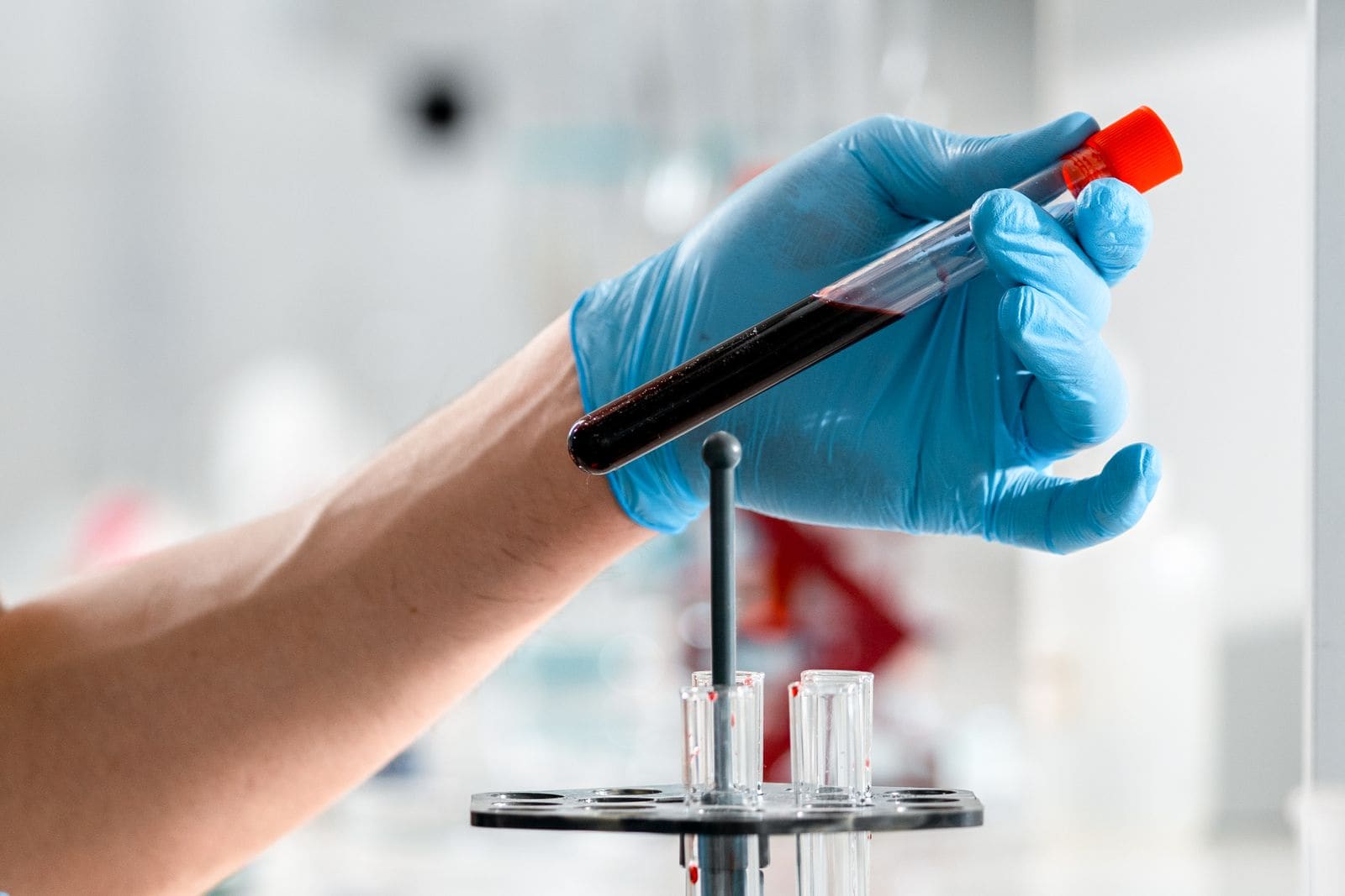 Gloved hand holding a test tube with a blood sample