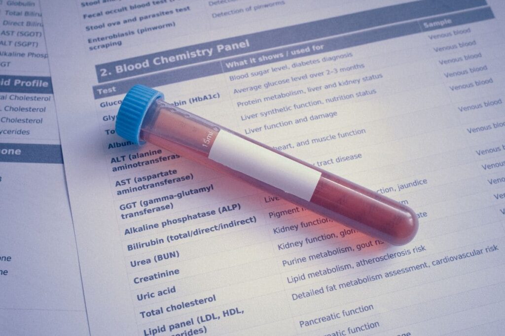 Blood sample tube resting on a printed blood test report