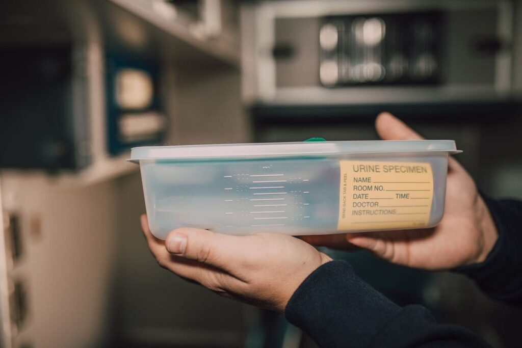 Hands holding a urine sample container in a laboratory