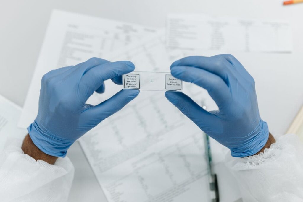 Gloved hands holding labelled microscope slides
